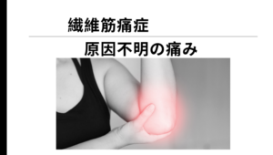 Read more about the article 線維筋痛症　原因不明の痛み